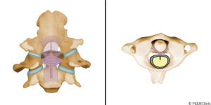 The-transverse-ligament-extends-from-the-medial-portion-of-one-lateral-mass-of-C1-to-the-medial-portion-of-the-contralateral-lateral-mass-of-C1----It-wraps-around-the-odontoid-process--