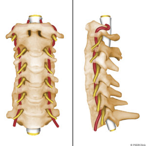 The-vertebral-artery-enters-the-transverse-foramina-typically-at-the-C6-level----In-approximally-15%-the-vertebral-artery-enters-at-C7----In-85%--the-C7-transverse-foramina-do-not-contain-the-vertebral-artery----The-vertebral-artery-takes-a-convoluted-course-between-C2--C1--and-the-occiput--